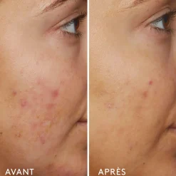 B3 Nice 10% Niacinamide Sérum Rééquilibrant