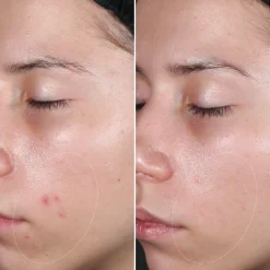 Capsules PURITY