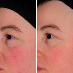 Capsules SKIN PERFECT