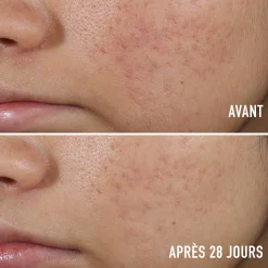 Sérum Anti-Imperfections
