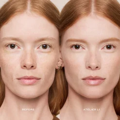 Vital Skincare Concealer Correcteur